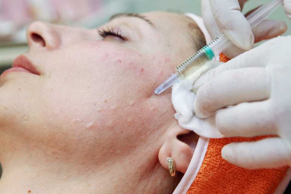 Биоревитализация лица