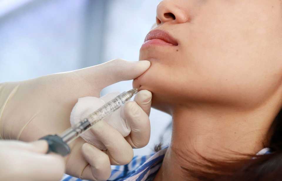 Врач вводит филлер в подбородок