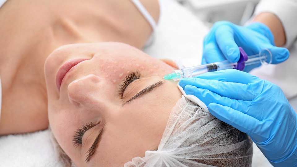 Косметолог проводит процедуру плазмолифтинга