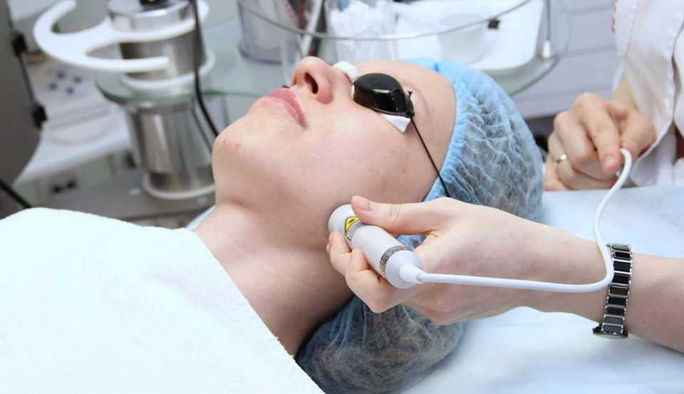 Лазерная гиалуронопластика лица