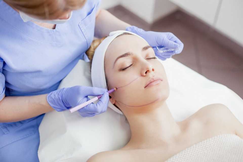 нитевой лифтинг