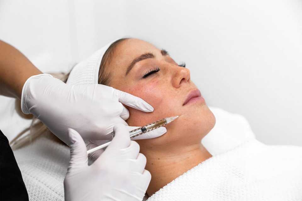 Плазмотерапия лица