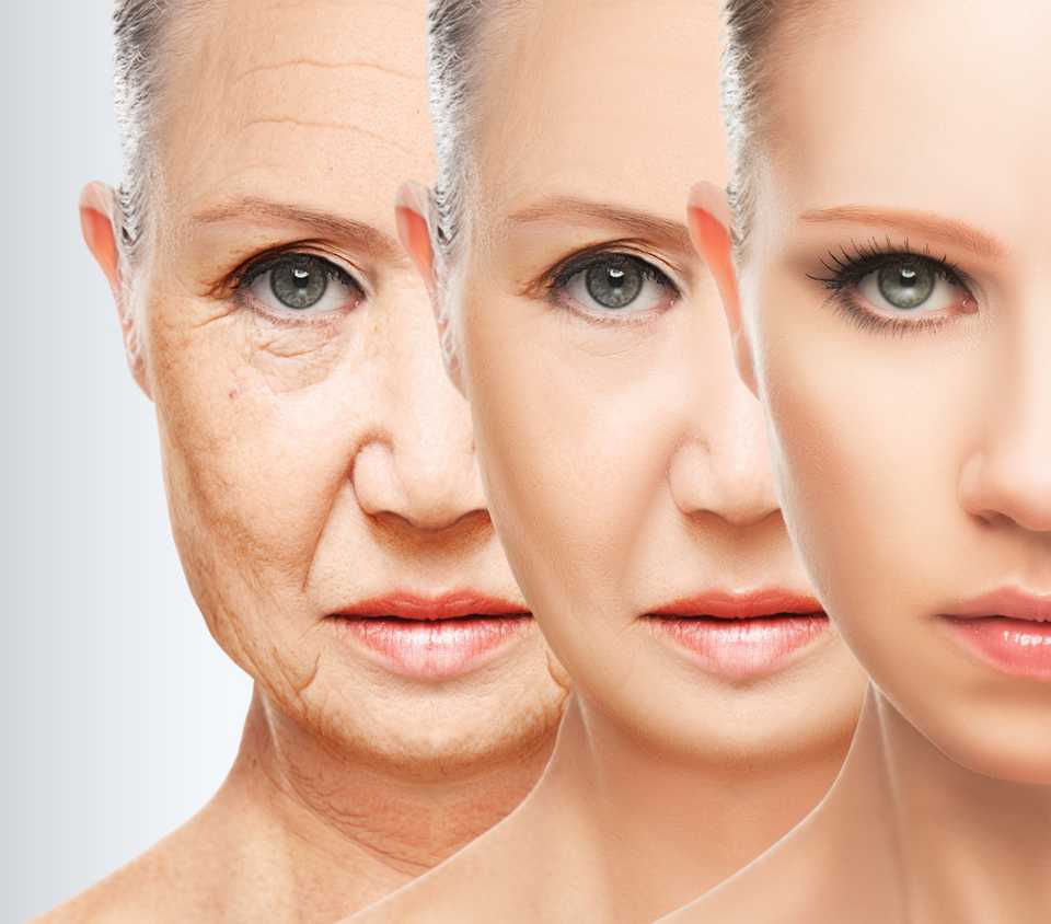 Этапы старения лица