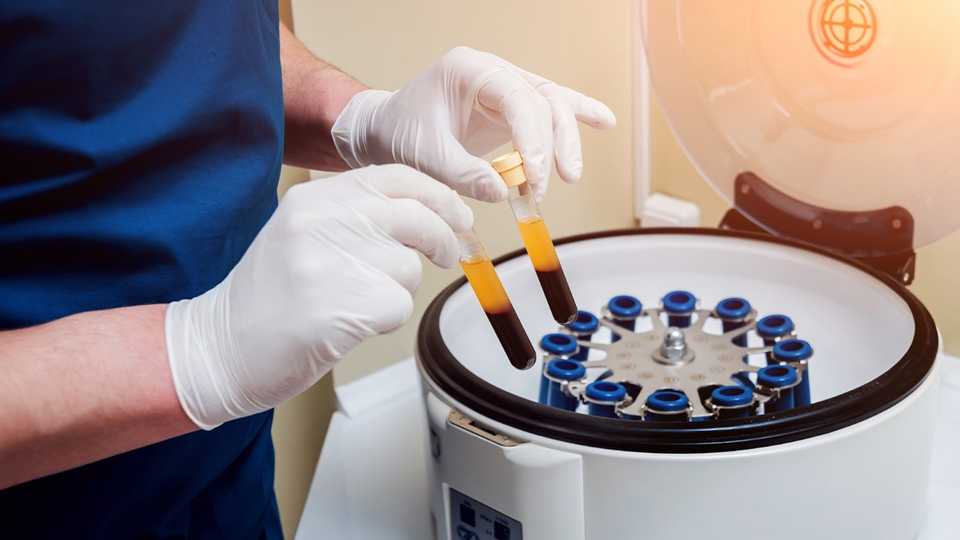 prp centrifuge